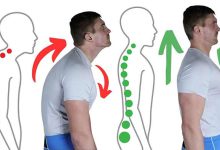 کیفوز کمری و لباس های مناسب افراد قوزدار