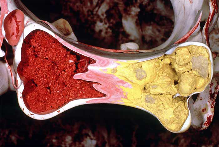 کم کاری مغز استخوان 